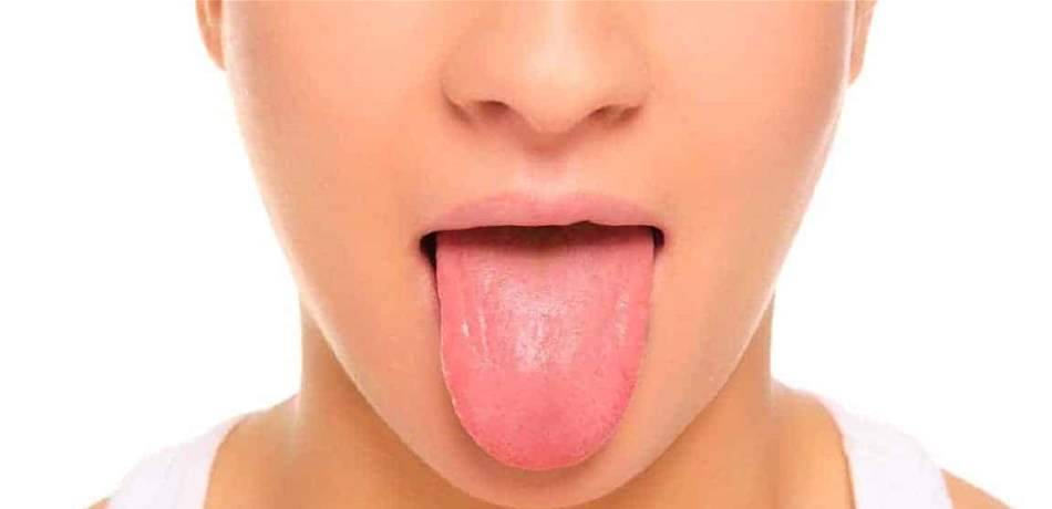 لسانك أبيض اللون.. استشر طبيبك في هذه الحالة!