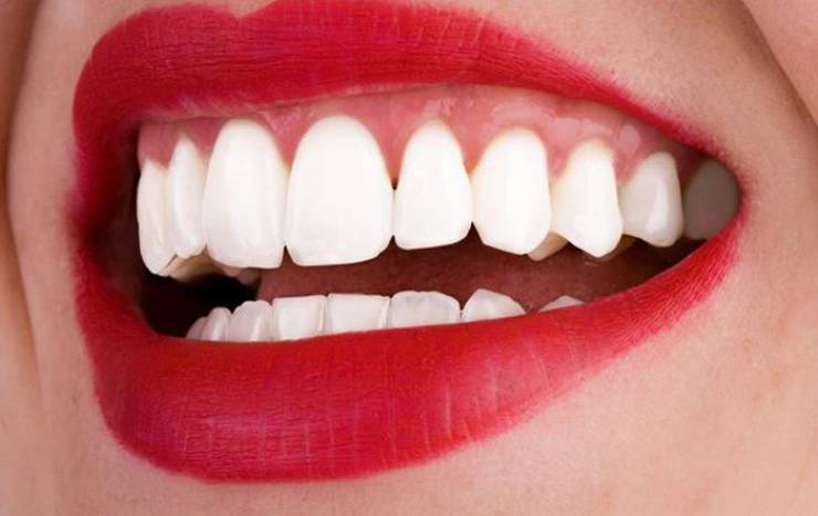 هذه الأطعمة تساعد في تبييض أسنانكم