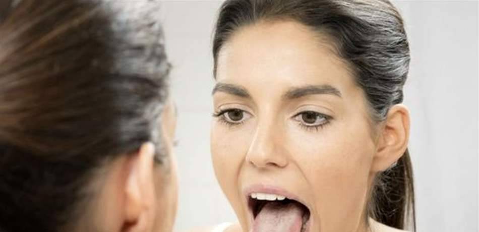 بحسب لسانك.. اكتشفي الأمراض التي تعانين منها