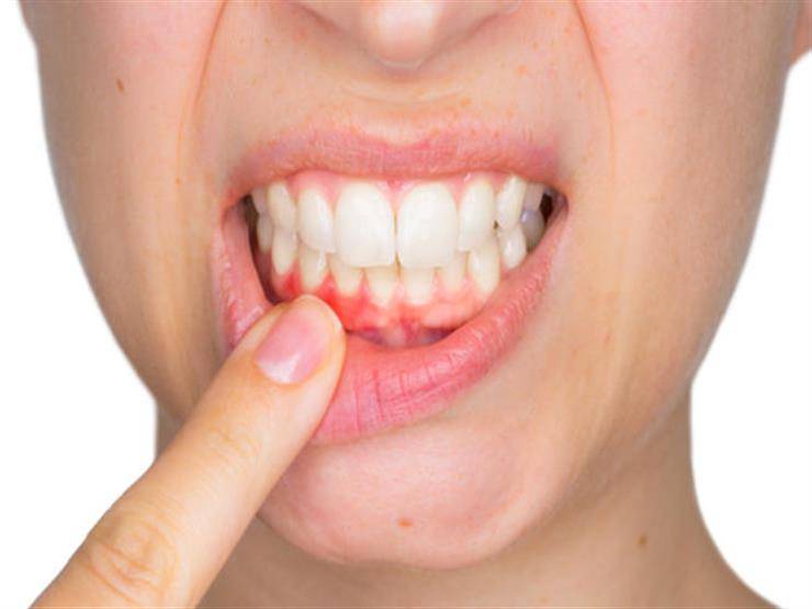 تعرف على العلاقة بين علاج اللثة والحد من ضغط الدم المرتفع