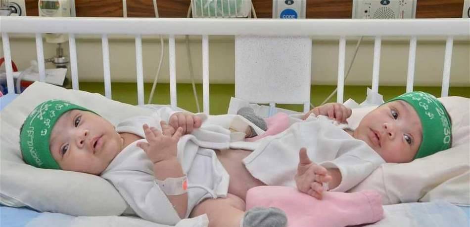 شيخة وشموخ.. نجاح الفصل النهائي للتوأم السعودي