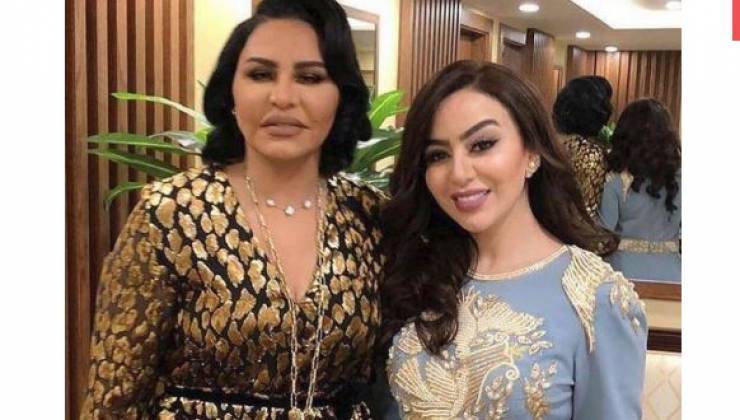 تغييرات تثير الجدل في وجه أحلام