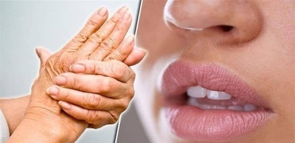 جفاف الفم مؤشر على هذا الالتهاب