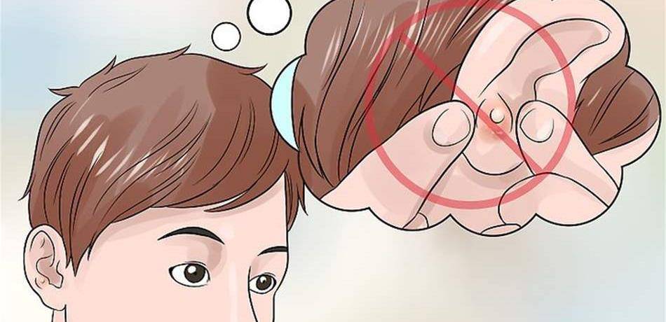 لا تستهينوا بـ"بثور الأذن".. هذه أسبابها وكيفية علاجها