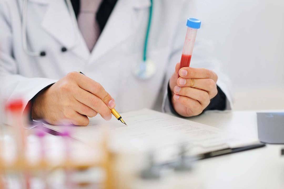اختبار دم جديد يساعد في علاج ارتجاج المخ