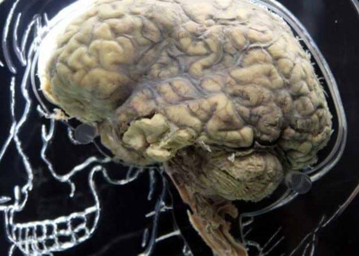 بكتيريا في أدمغة البشر.. كيف وصلت وماذا تفعل؟