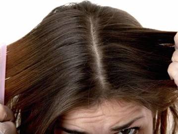 زيت النيم للتخلص من قشرة الرأس