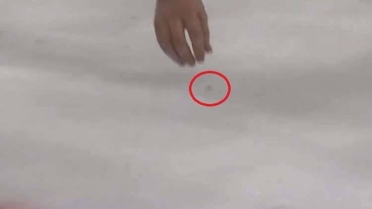 بالفيديو.. ابتسامة "دموية" من لاعب هوكي الجليد فَقَدَ سنه