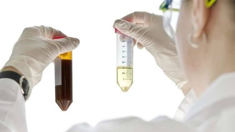 مفاجأة علمية.. تطوير خلايا دماغية بدلا من الكلى البشرية في المختبر