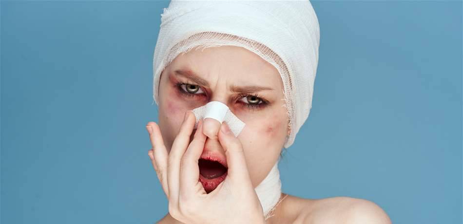 صيحة غريبة تجتاح "إنستغرام".. تنافس جراحات تجميل الأنف!
