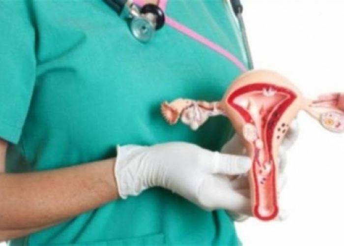 عدد الوفيات جراء سرطان عنق الرحم في ارتفاع بشكل كبير في لبنان