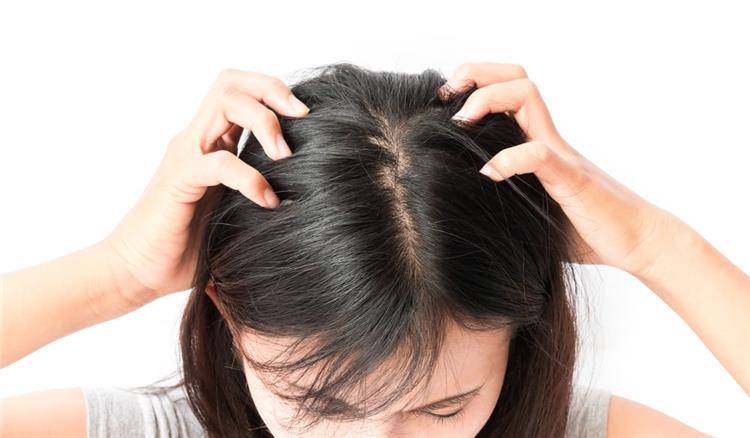 علاج حكة الرأس بطرق منزلية