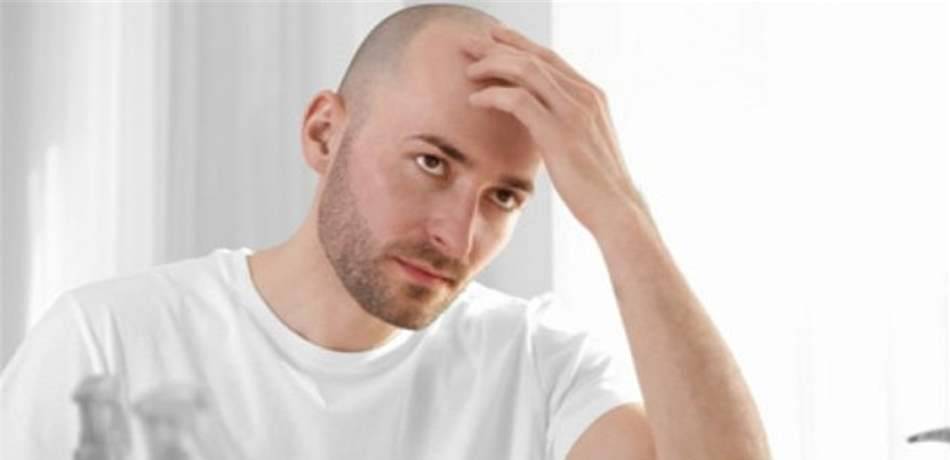 وداعاً لمشكلة الصلع مع هذا الاكتشاف العلمي..
