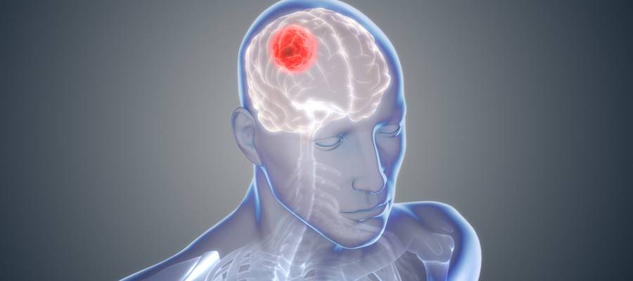 العلماء يحددون كيفية تطوّر السرطان الذي أودى بحياة السيناتور الأميركي ماكين.. ذكي وعدائي جداً