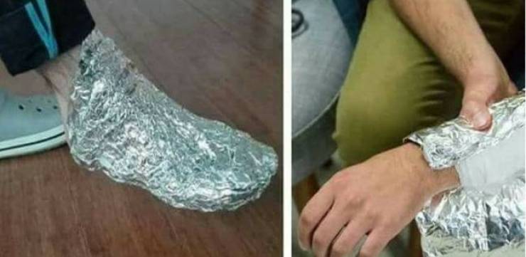 هل يمكن علاج المفاصل بورق الالمنيوم ؟