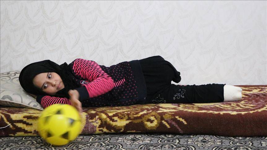 مريم.. طفلة سوريا تنتظر قدمين اصطناعيتين بعد أن فقدتهما جراء القصف