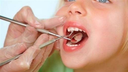 تسوّس الأسنان.. دليل على نقص هذا الفيتامين من جسمك