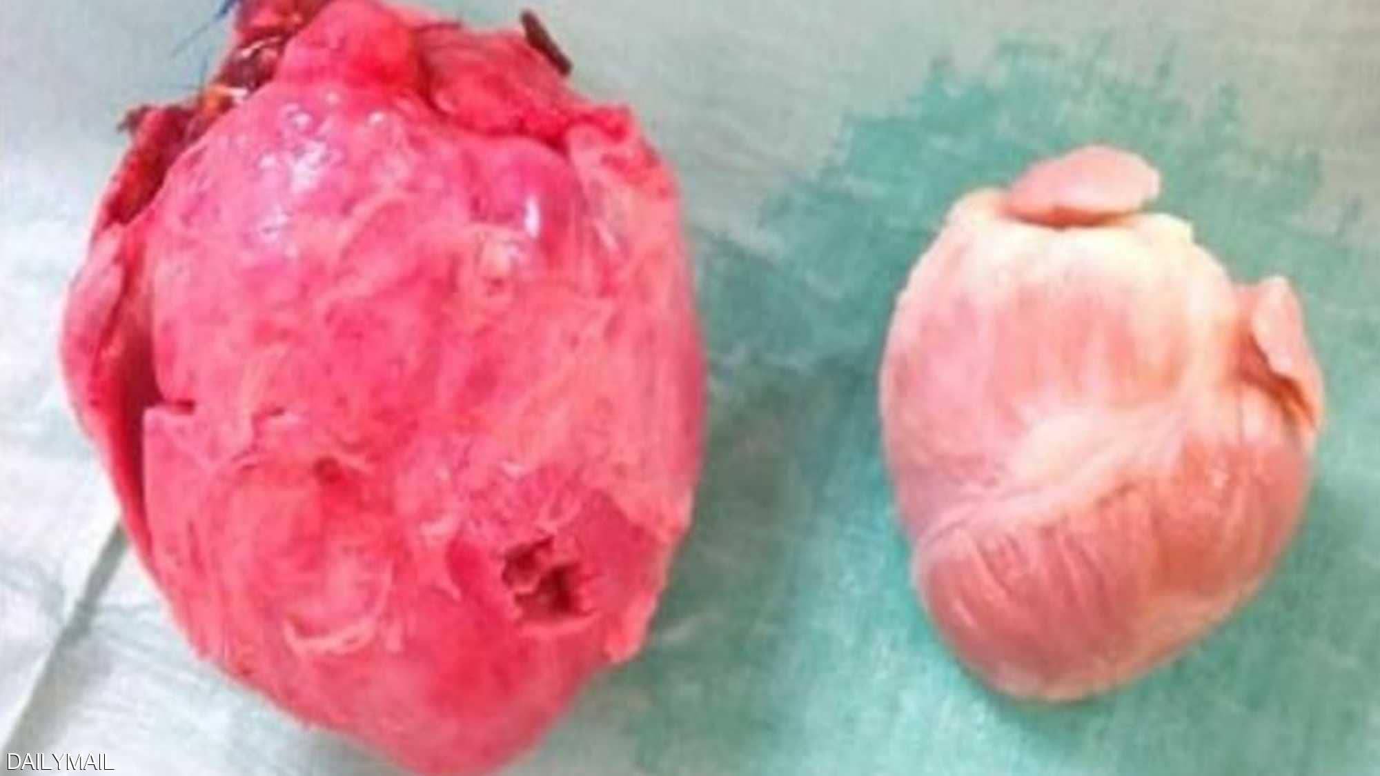 ثورة طبية على الطريق.. أعضاء الحيوانات ستنقل إلى البشر