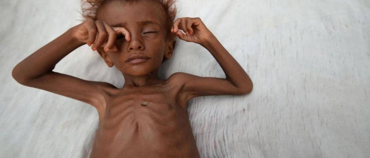 خبر خطير...7 ملايين طفل يمني ينامون جياعاً!