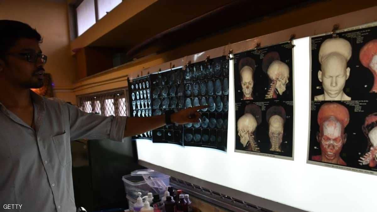عادة يومية تقلل من خطر الإصابة بألزهايمر