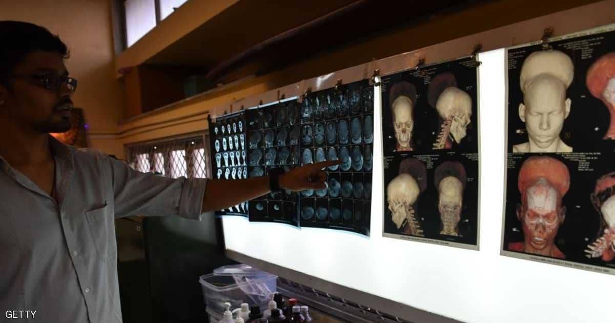 عادة يومية تقلل من خطر الإصابة بألزهايمر