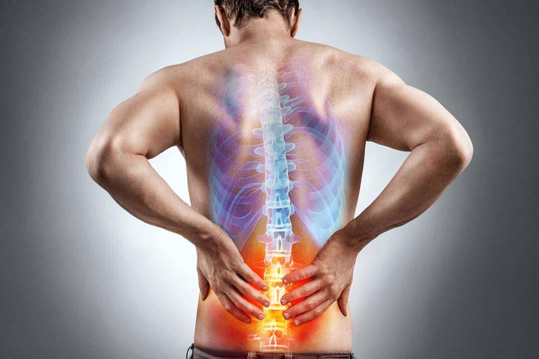 تزداد في الشتاء.. علاج فعال لآلام الظهر