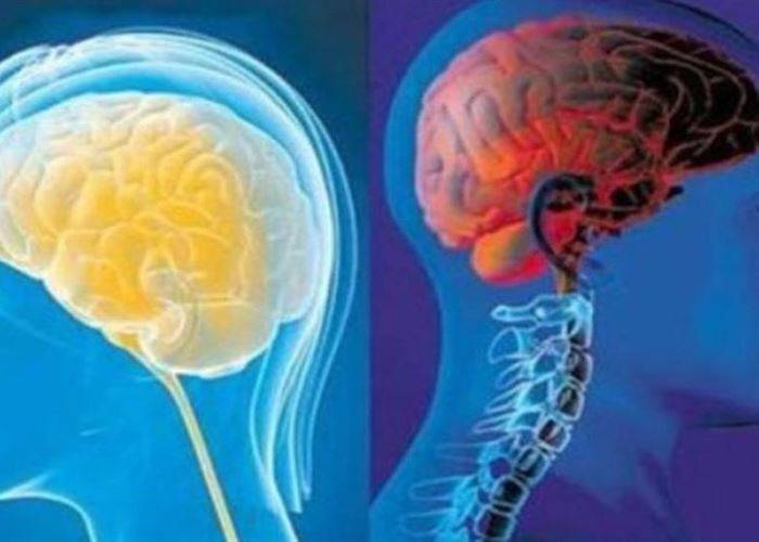 فرق بين أدمغة النساء والرجال