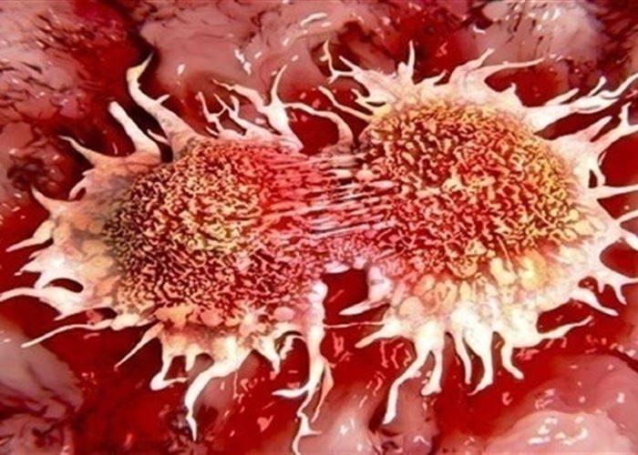 أسباب خفية للسرطان يجهلها الكثيرون!