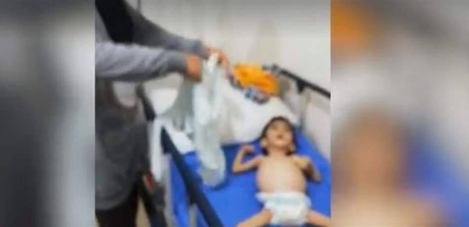 مأساة جديدة على أبواب المستشفيات..الطفل محمد في خطر (فيديو)