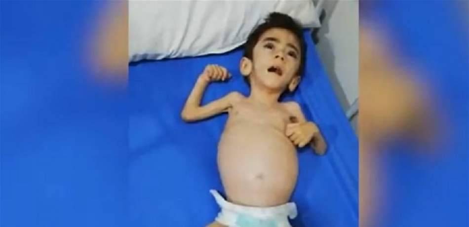 بعد ما قيل عن رفضه استقبال الطّفل "محمّد".. مركز "اليوسف" يوضح!
