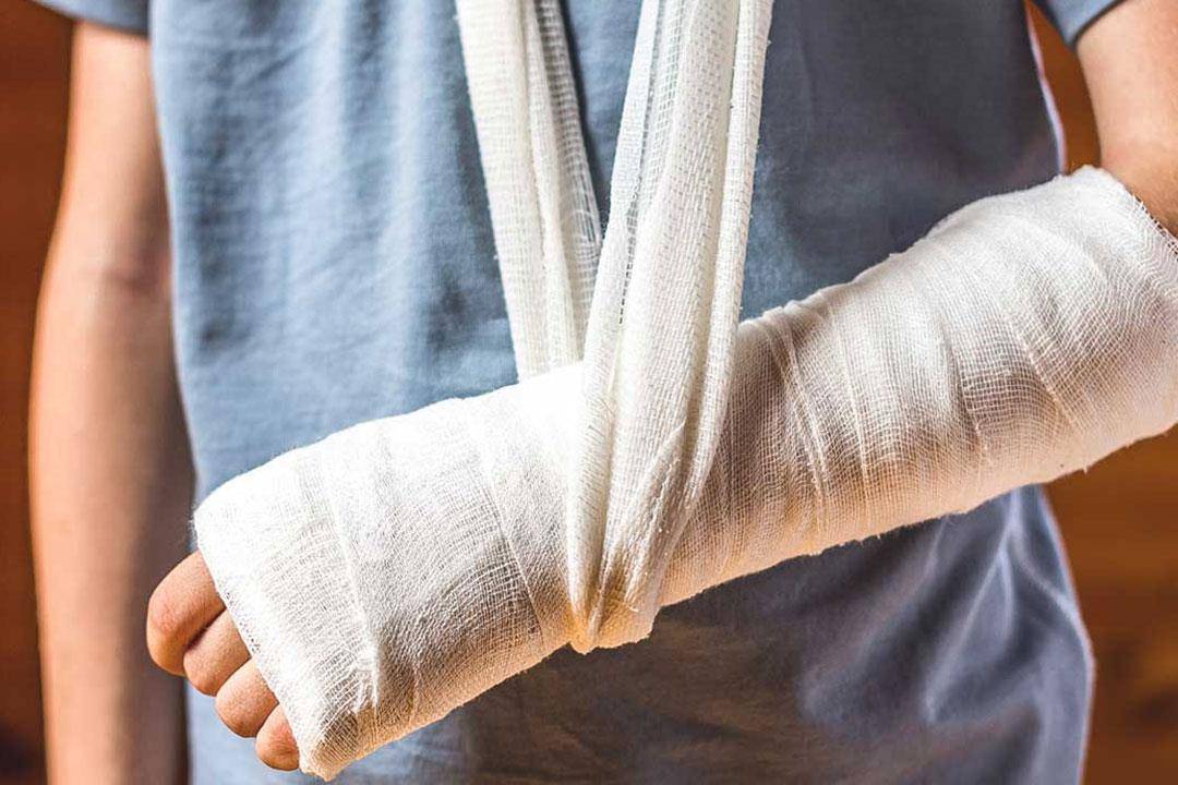 العلاج الطبيعي ضروري بعد كسور العظام.. هذه أضرار إهماله