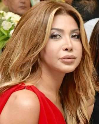 تورم صادم في وجه نوال الزغبي: هذه اللقطة من دون فوتوشوب