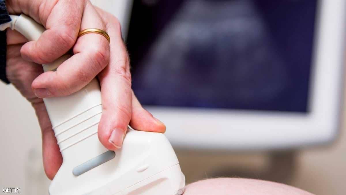 مفاجأة تذهل العلماء.. اكتشاف نوع نادر من التوائم البشرية