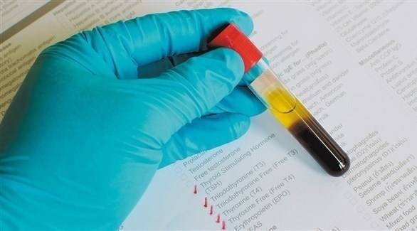 هل تحتاج إلى فحص هرمون الغدة الدرقية؟
