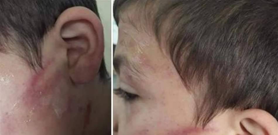 والد الطفل "هادي" في قبضة الأمن