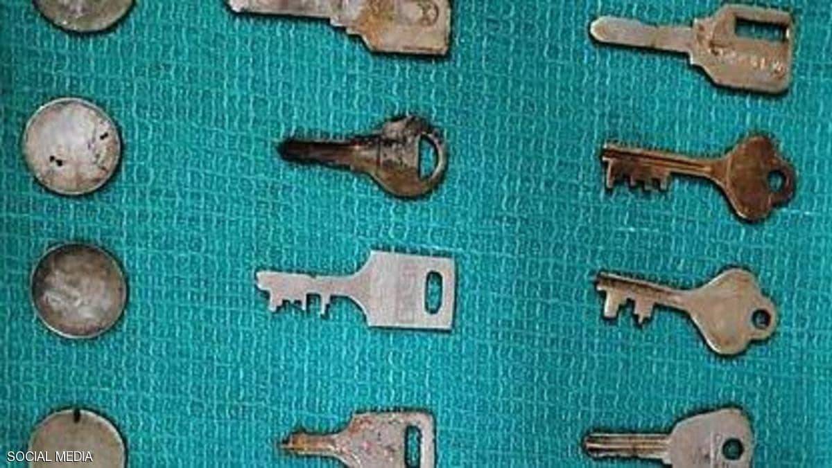 مفاتيح وعملات وشريحة هاتف وشفرة في معدة "الرجل المغناطيس"