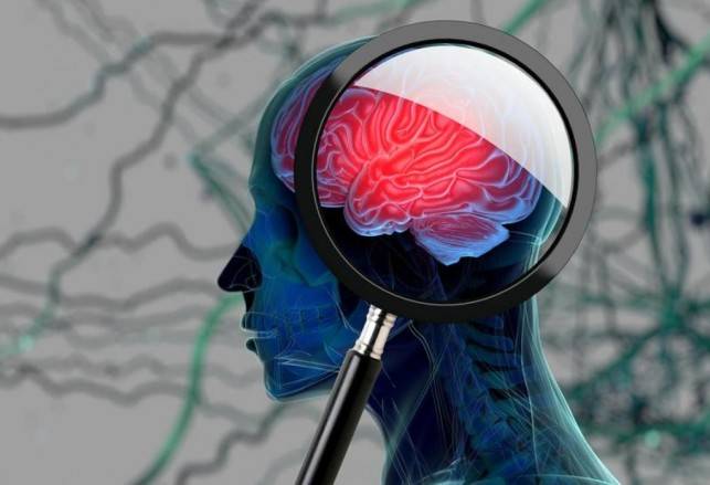 النسيان دليل على الذكاء.. وليس الغباء