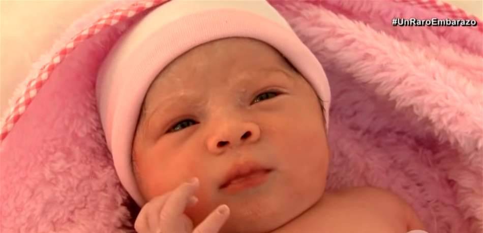 ظاهرة نادرة تحدث مرة واحدة كل 200 ألف حالة..جنين داخل جنين!