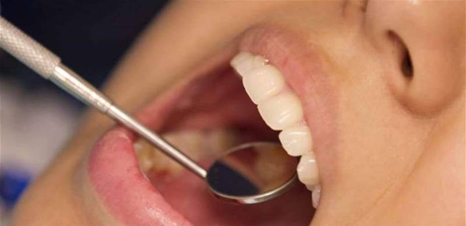 ما هي العلاقة بين أمراض اللثة وخطر الإصابة بالخرف؟