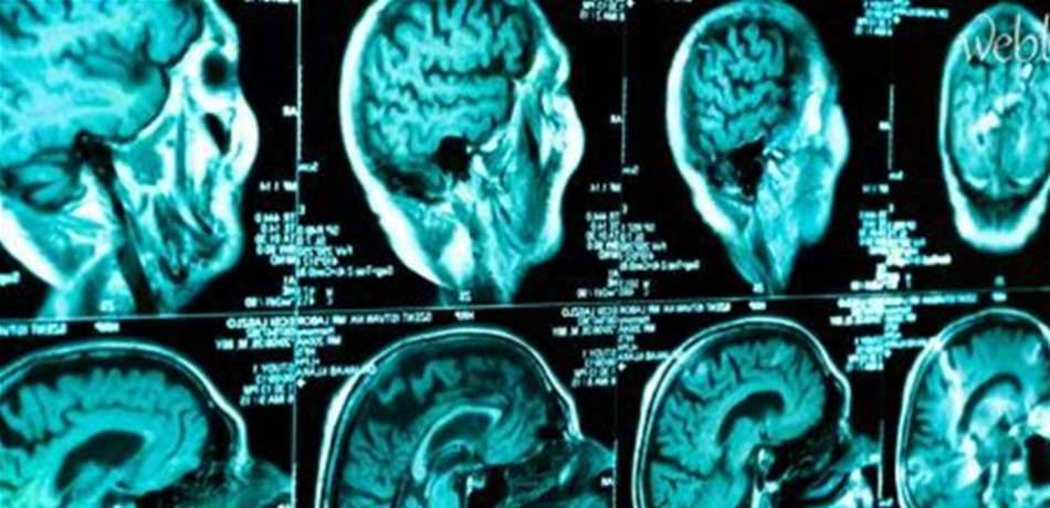 لا تتجاهل هذه الأعراض.. قد تؤشر الى الاصابة بنوع قاتل من السرطان!