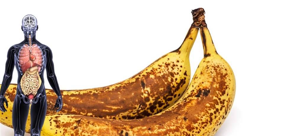 هل تحبون موز "أبو نقطة"؟.. هذا ما يفعله بالجسم