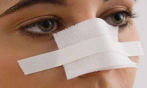 تقنية مذهلة لتجميل الأنف خلال 5 دقائق ودون جراحة!