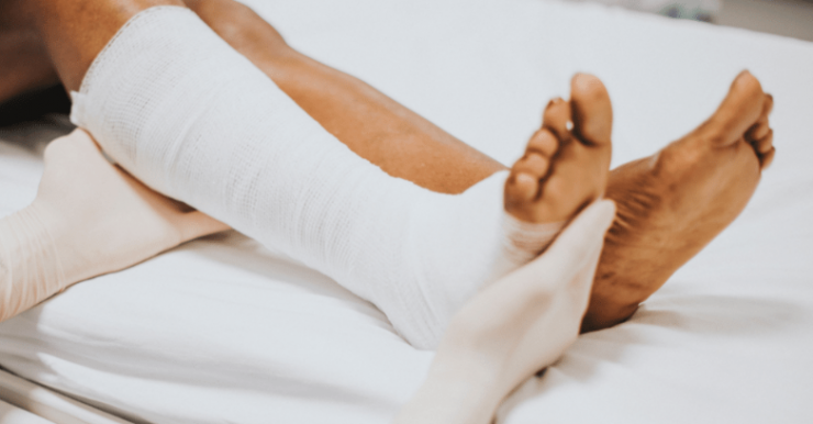 تقنية جديدة للتخلص من تجلطات الساق