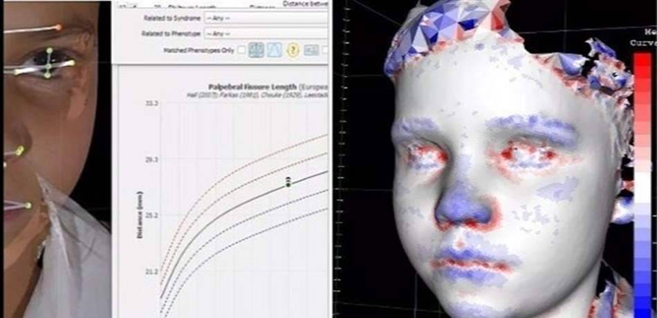 صورة 3D للوجه تكشف أمراضاً نادرة!