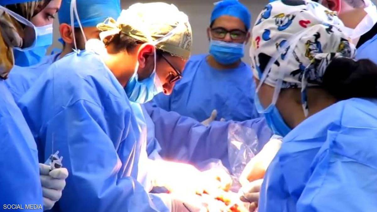مصر.. عملية جراحية "غير مسبوقة" لجنين في رحم أمه