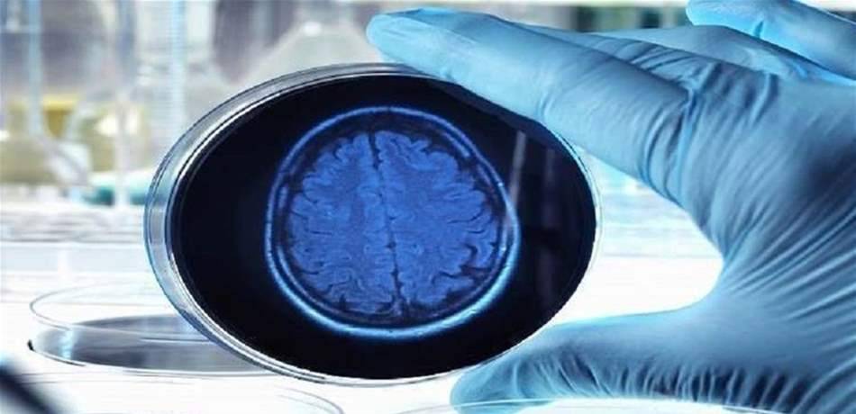 نظرية جديدة حول المسببات الأساسية لألزهايمر