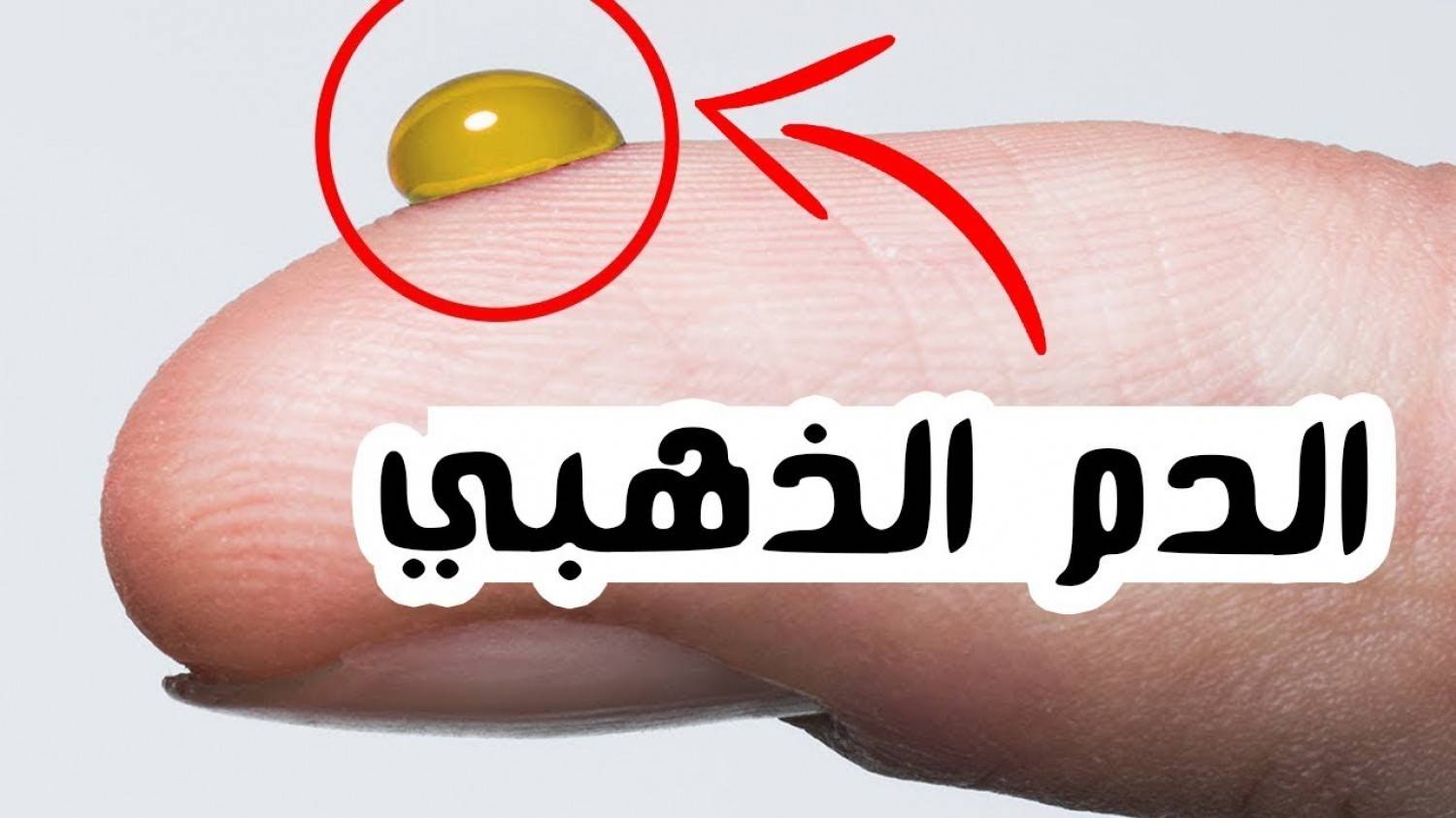 تعرفوا على "الدم الذهبي"..حالة نادرة لدى 43 شخص في العالم
