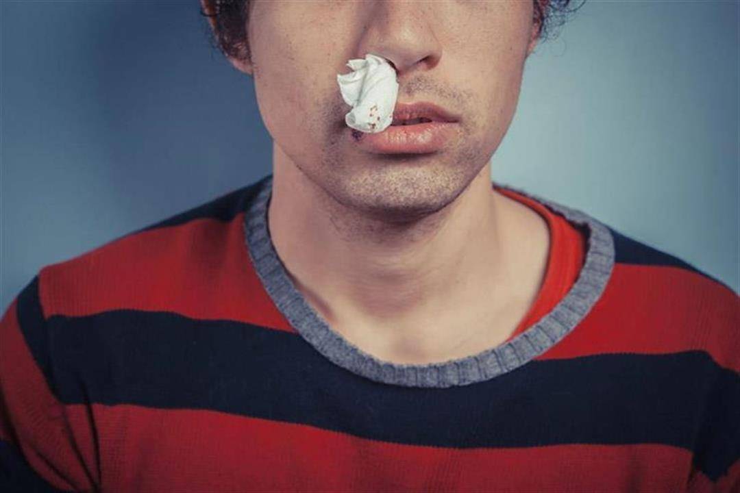 أنفك ينزف في الصيف؟.. حالات تستوجب زيارة الطبيب فورًا