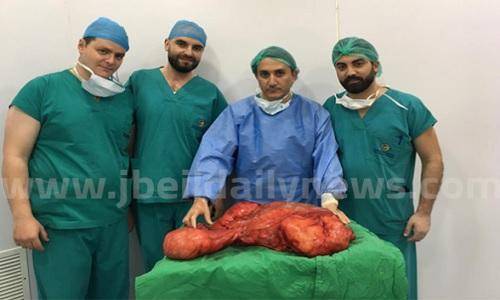 بالصورة: إنجاز طبي في "المعونات"... استئصال ورم يزن 15 كلغ!