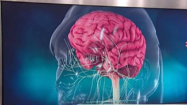 التصلب المتعدد الأعراض.. علاجه والوقاية منه